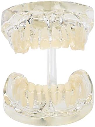 Modelo de escovação de dentes de Akozon, Dentes Dentais Dentes Dentes Removíveis Ferramenta de Ensino para Dentista